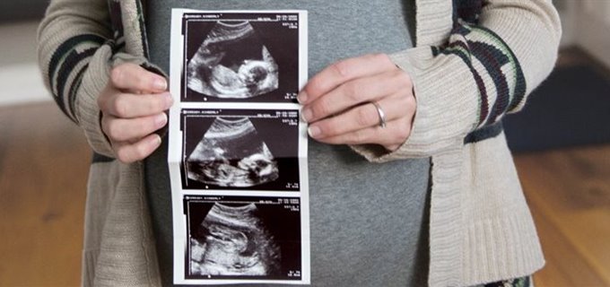 5 consejos para un embarazo saludable